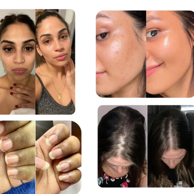 Péptidos Bioactivos de Colágeno  Tipo I,II,III,V, X
